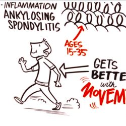 causes of back pain explained